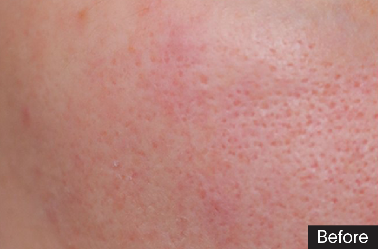 Mặt Nạ Phục Hồi Tái Tạo GSC Rebirth & Recovery Mask 10 Miếng