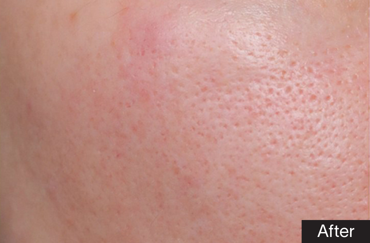 Mặt Nạ Phục Hồi Tái Tạo GSC Rebirth & Recovery Mask 10 Miếng
