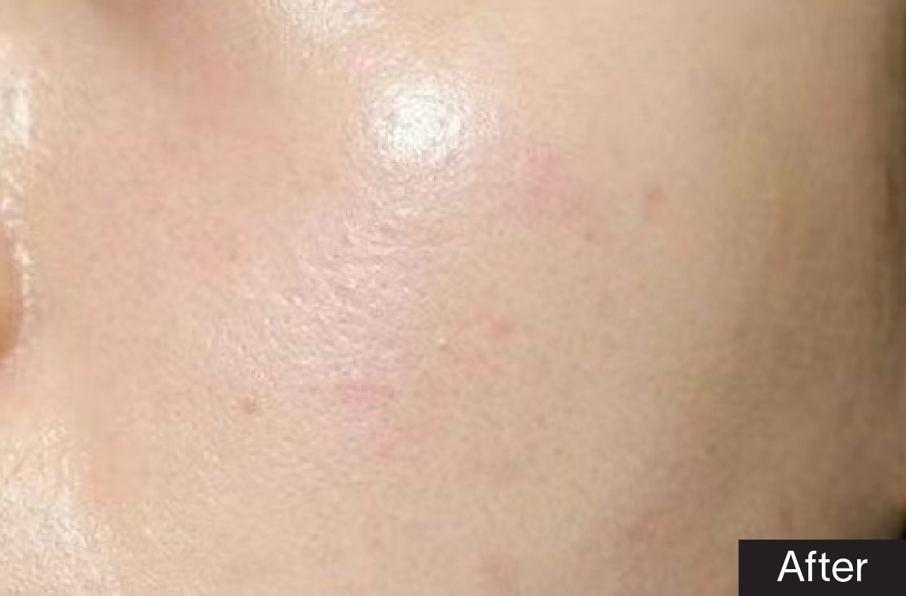 Tinh chất phục hồi GSC Advanced Repair Serum 30 Ml